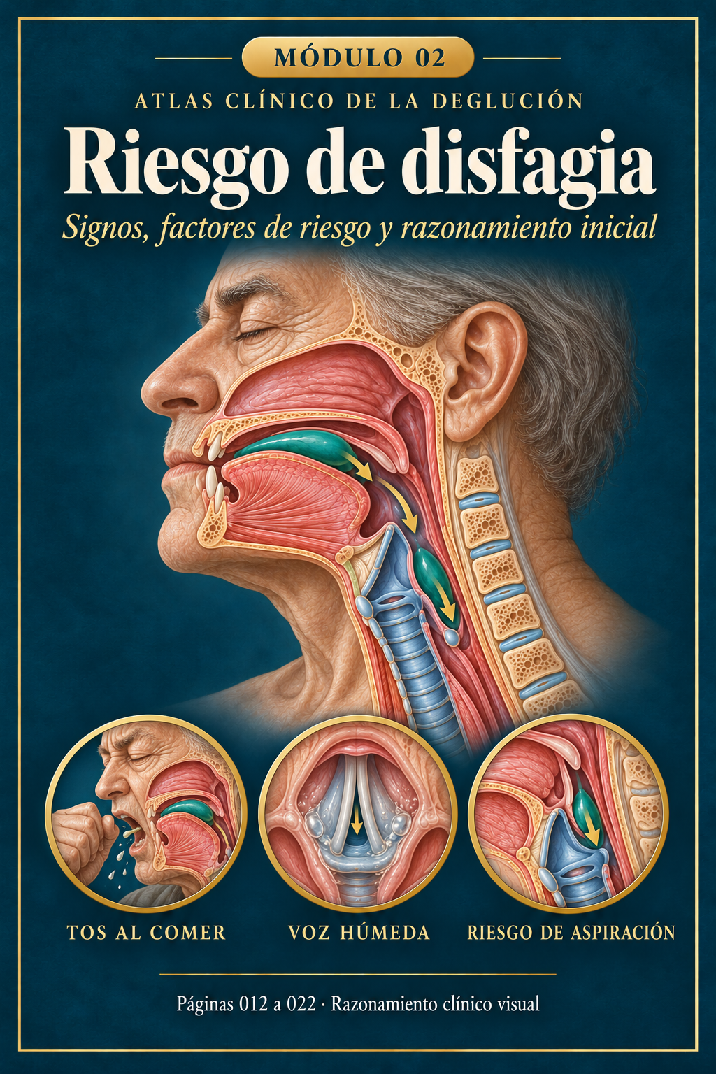Portada del módulo 02: Riesgo de disfagia